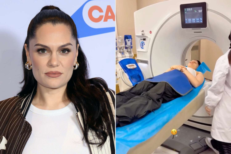 jessie j got an mri after hitting her head