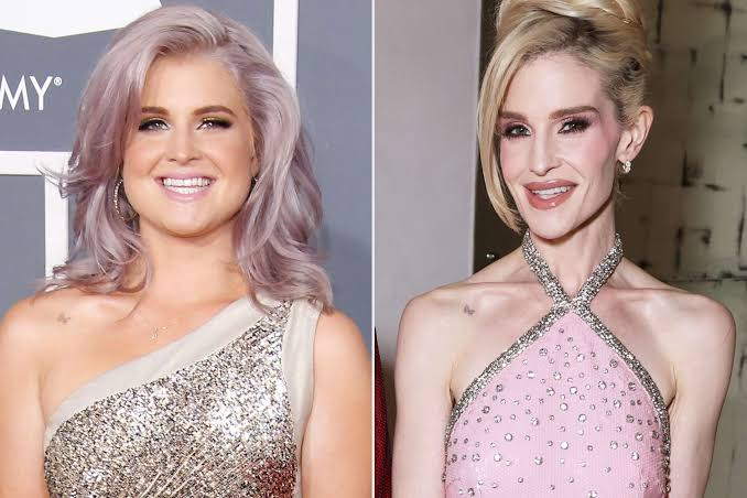 kelly osbourne before and after